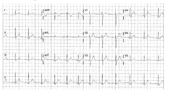 This image has an empty alt attribute; its file name is image-60.png