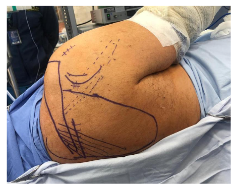 This image has an empty alt attribute; its file name is image-90.png