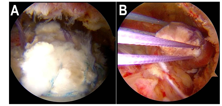 This image has an empty alt attribute; its file name is image-93.png