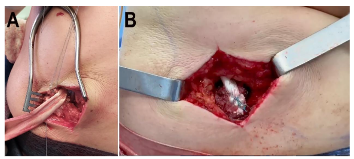 This image has an empty alt attribute; its file name is image-94.png