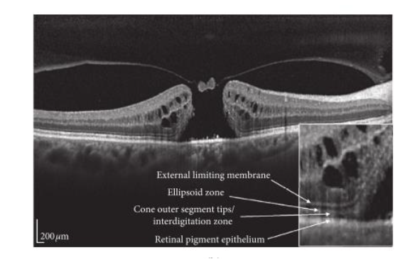 This image has an empty alt attribute; its file name is image-120.png