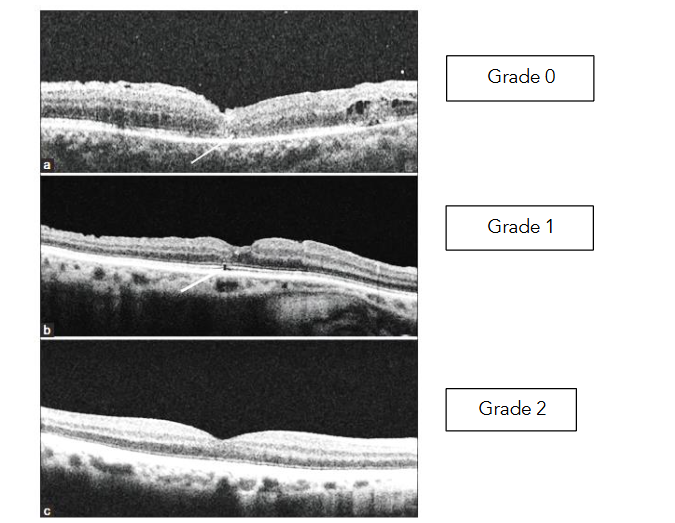 This image has an empty alt attribute; its file name is image-121.png