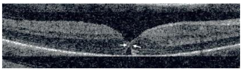 This image has an empty alt attribute; its file name is image-122.png