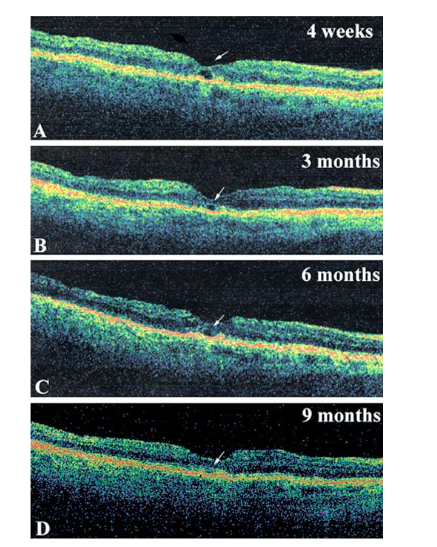 This image has an empty alt attribute; its file name is image-123.png