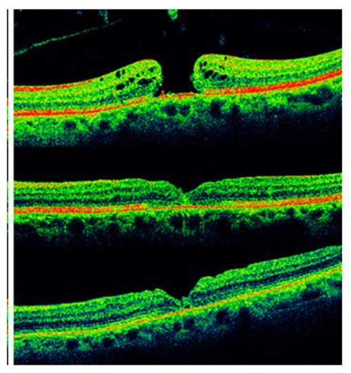 This image has an empty alt attribute; its file name is image-125.png