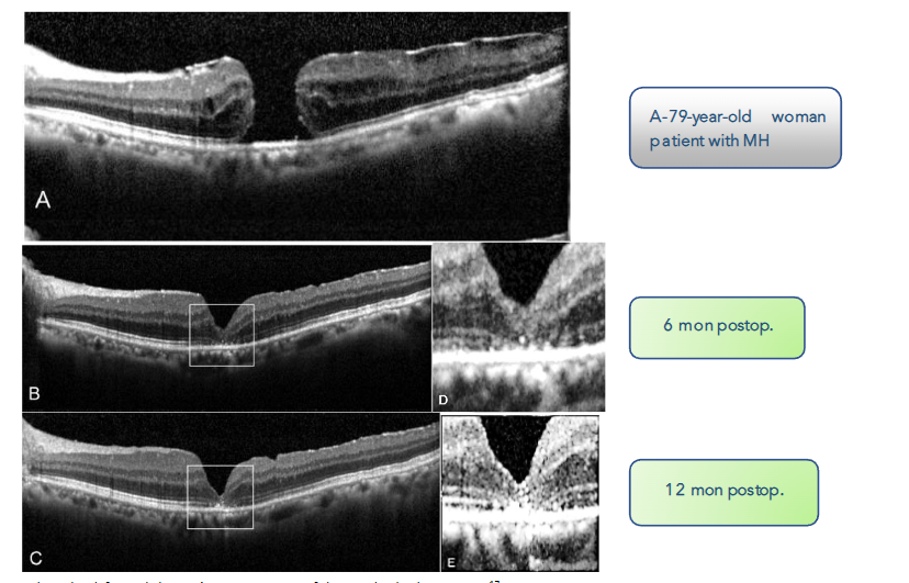 This image has an empty alt attribute; its file name is image-126.png