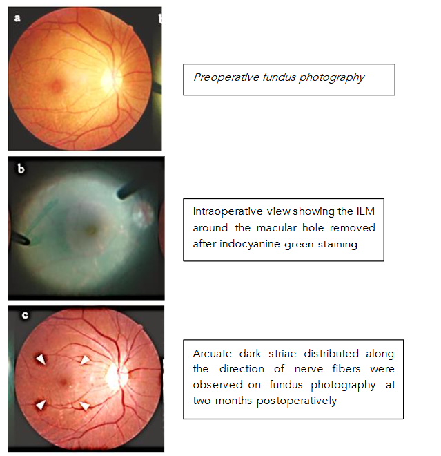 This image has an empty alt attribute; its file name is image-127.png