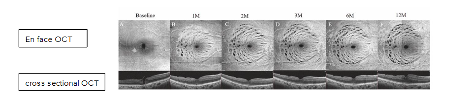 This image has an empty alt attribute; its file name is image-128.png