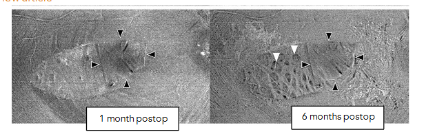 This image has an empty alt attribute; its file name is image-129.png