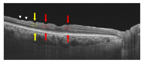 This image has an empty alt attribute; its file name is image-130.png