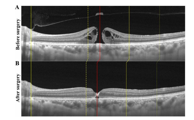 This image has an empty alt attribute; its file name is image-131.png