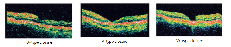 This image has an empty alt attribute; its file name is image-133.png