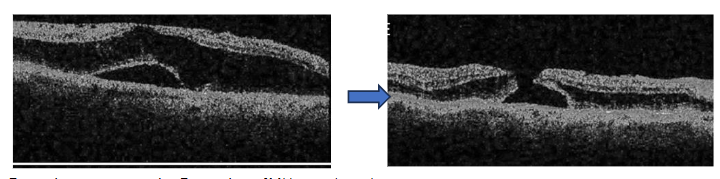 This image has an empty alt attribute; its file name is image-136.png