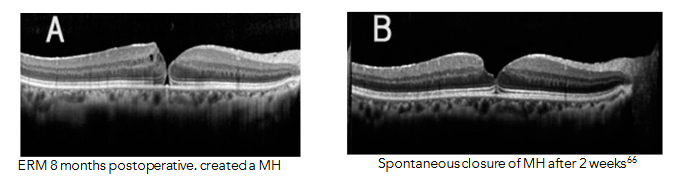 This image has an empty alt attribute; its file name is image-137.png