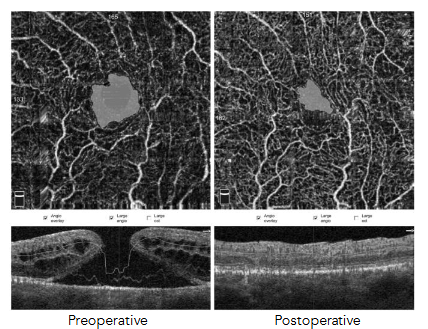 This image has an empty alt attribute; its file name is image-138.png