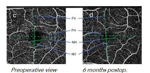 This image has an empty alt attribute; its file name is image-139.png