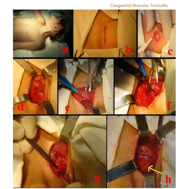 This image has an empty alt attribute; its file name is image-150.png