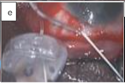 This image has an empty alt attribute; its file name is image-175.png