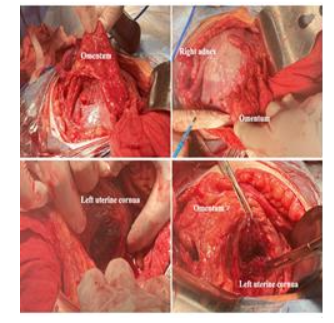 This image has an empty alt attribute; its file name is image-68.png