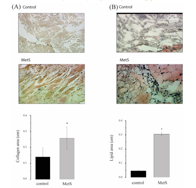 This image has an empty alt attribute; its file name is image.png