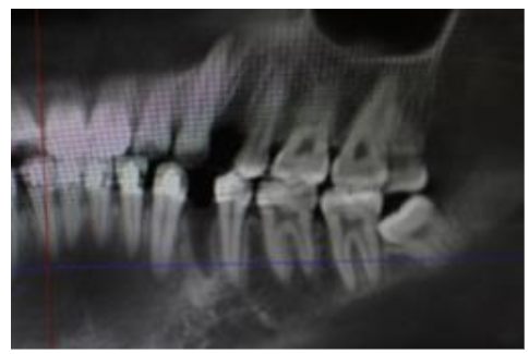 This image has an empty alt attribute; its file name is image-12.png