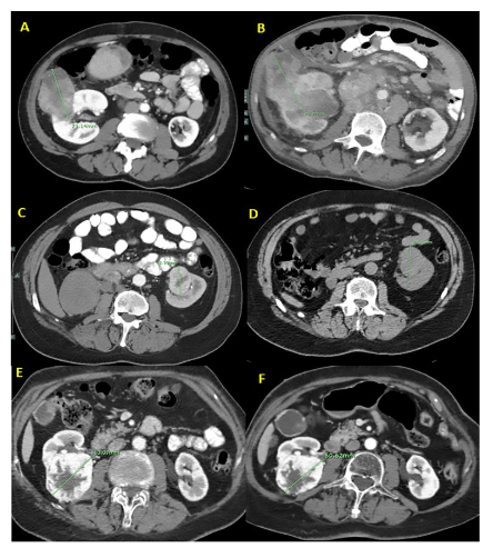 This image has an empty alt attribute; its file name is image-120.png