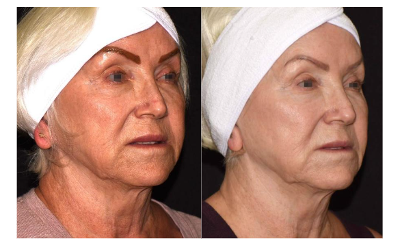 This image has an empty alt attribute; its file name is image-123.png