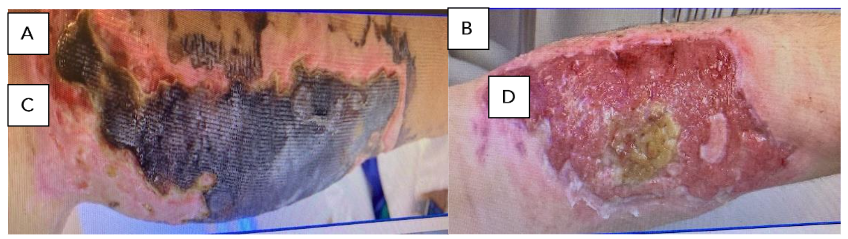 This image has an empty alt attribute; its file name is image-63.png