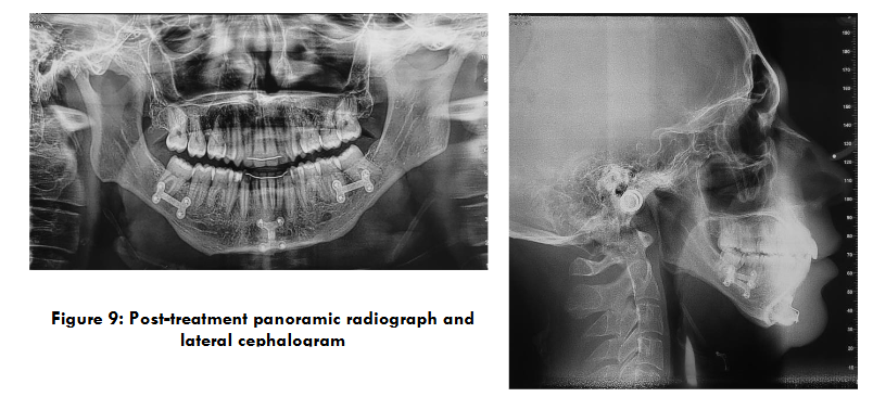 This image has an empty alt attribute; its file name is image-66.png