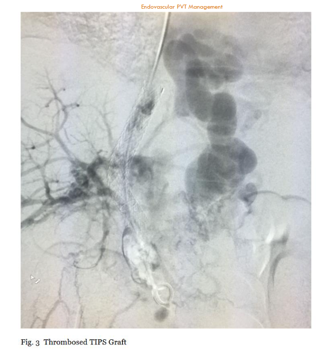 This image has an empty alt attribute; its file name is image-69.png