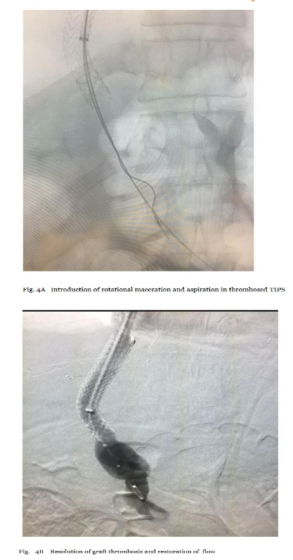 This image has an empty alt attribute; its file name is image-70.png