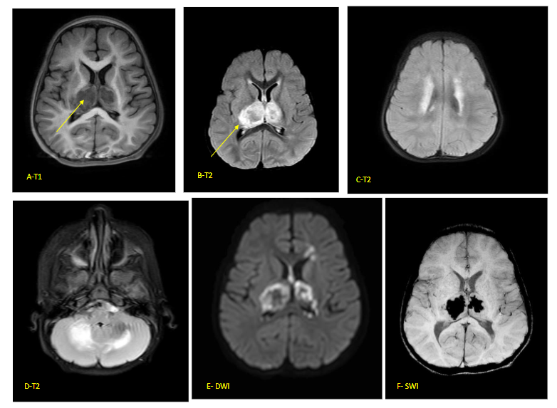 This image has an empty alt attribute; its file name is image-92.png