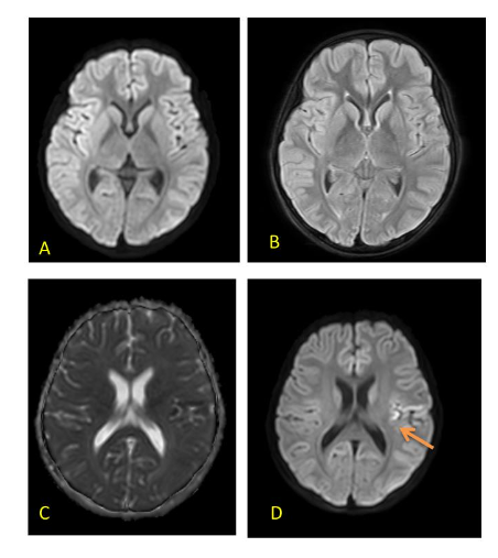 This image has an empty alt attribute; its file name is image-93.png