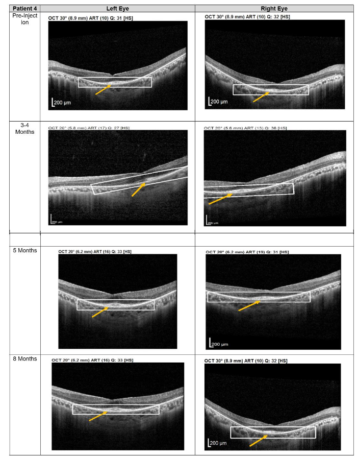 This image has an empty alt attribute; its file name is Screenshot-2026-02-02-075203.png