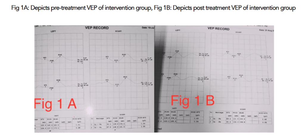 This image has an empty alt attribute; its file name is image-160-1024x453.png