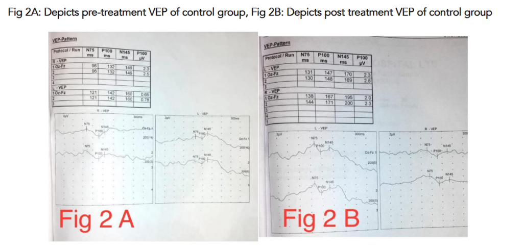 This image has an empty alt attribute; its file name is image-161-1024x488.png