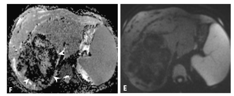 This image has an empty alt attribute; its file name is image-169.png