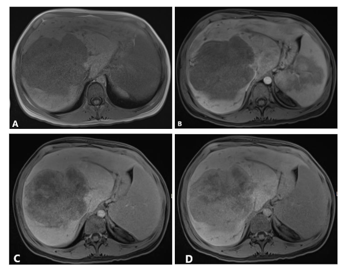 This image has an empty alt attribute; its file name is image-170.png