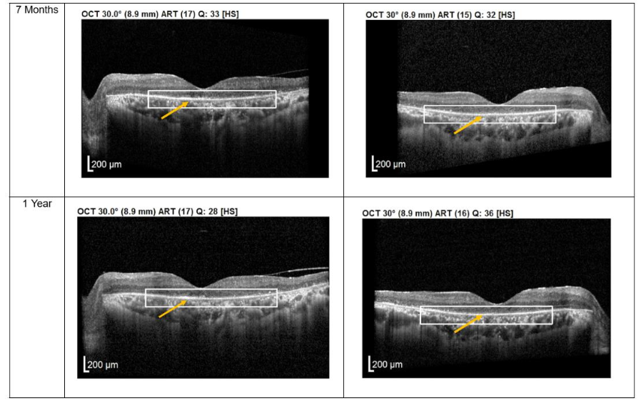 This image has an empty alt attribute; its file name is image-27.png