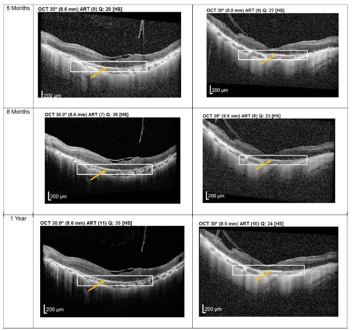 This image has an empty alt attribute; its file name is image-28.png