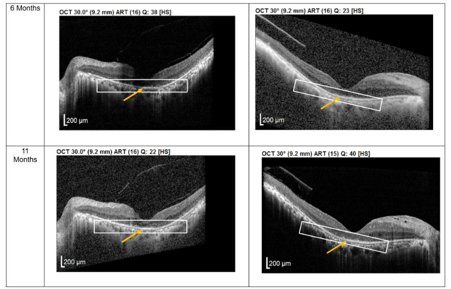 This image has an empty alt attribute; its file name is image-29.png