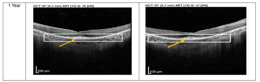 This image has an empty alt attribute; its file name is image-31.png