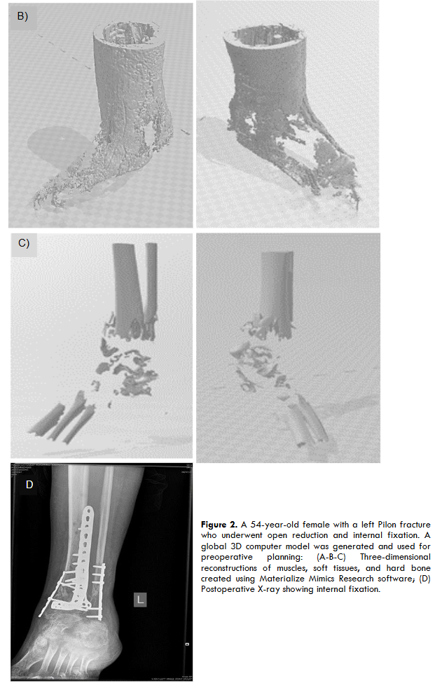 This image has an empty alt attribute; its file name is image-100.png