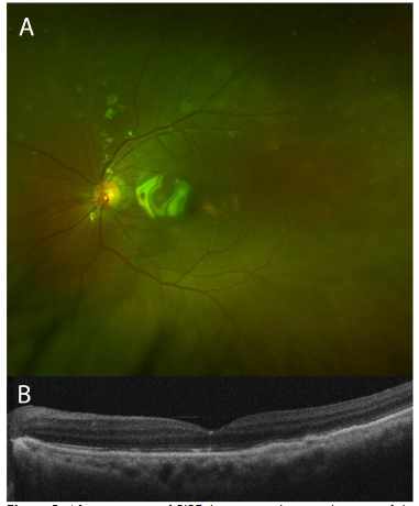 This image has an empty alt attribute; its file name is image-115.png