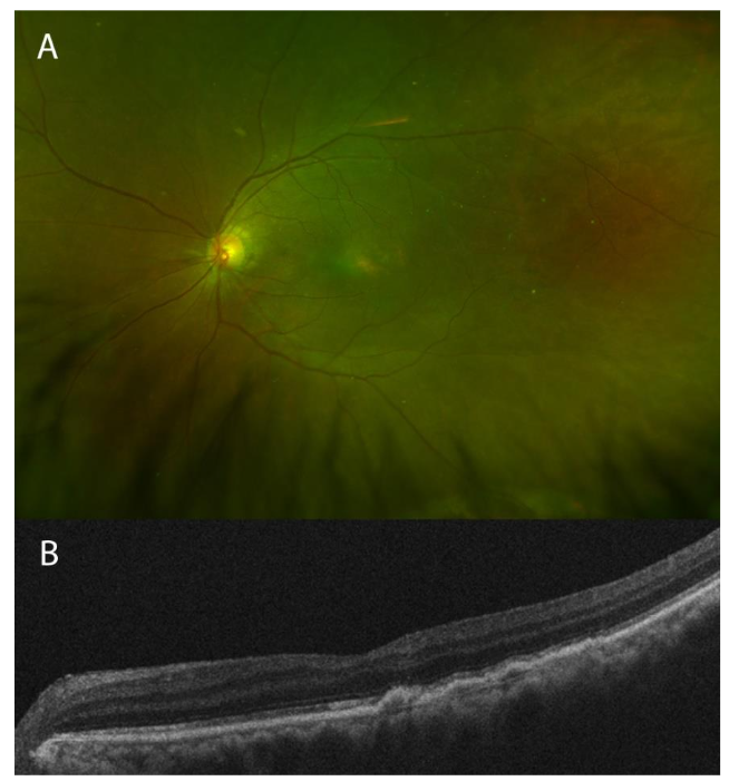 This image has an empty alt attribute; its file name is image-117.png