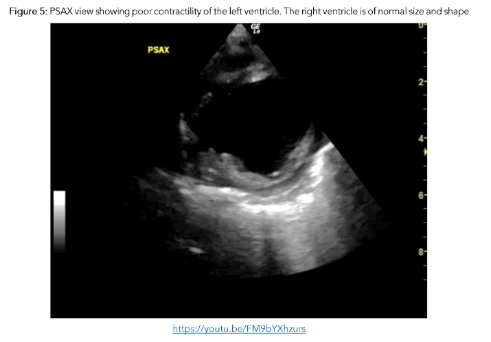 This image has an empty alt attribute; its file name is image-125.png