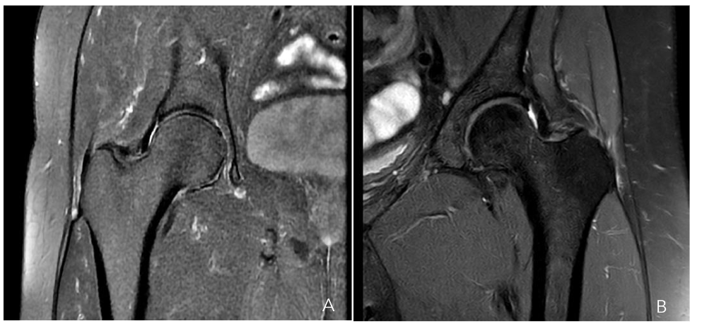 This image has an empty alt attribute; its file name is image-139.png