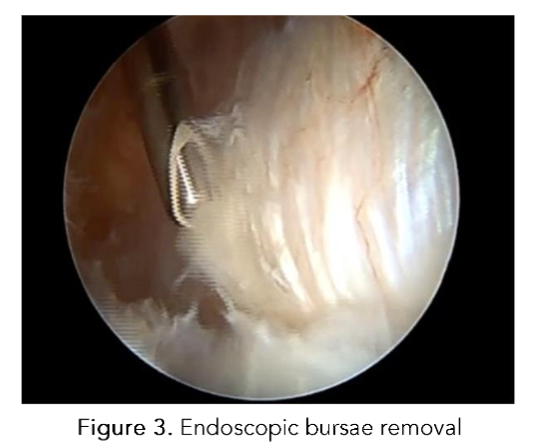 This image has an empty alt attribute; its file name is image-141.png