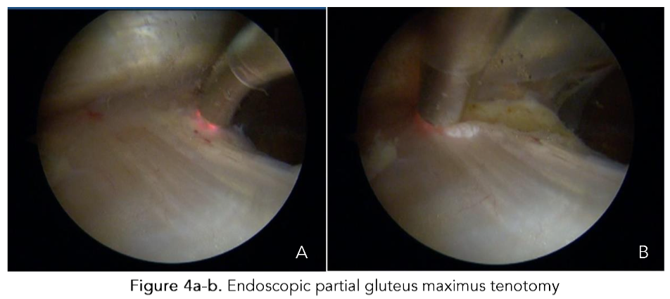 This image has an empty alt attribute; its file name is image-142.png