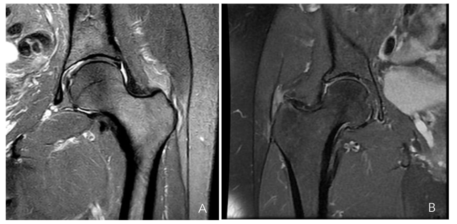 This image has an empty alt attribute; its file name is image-144.png